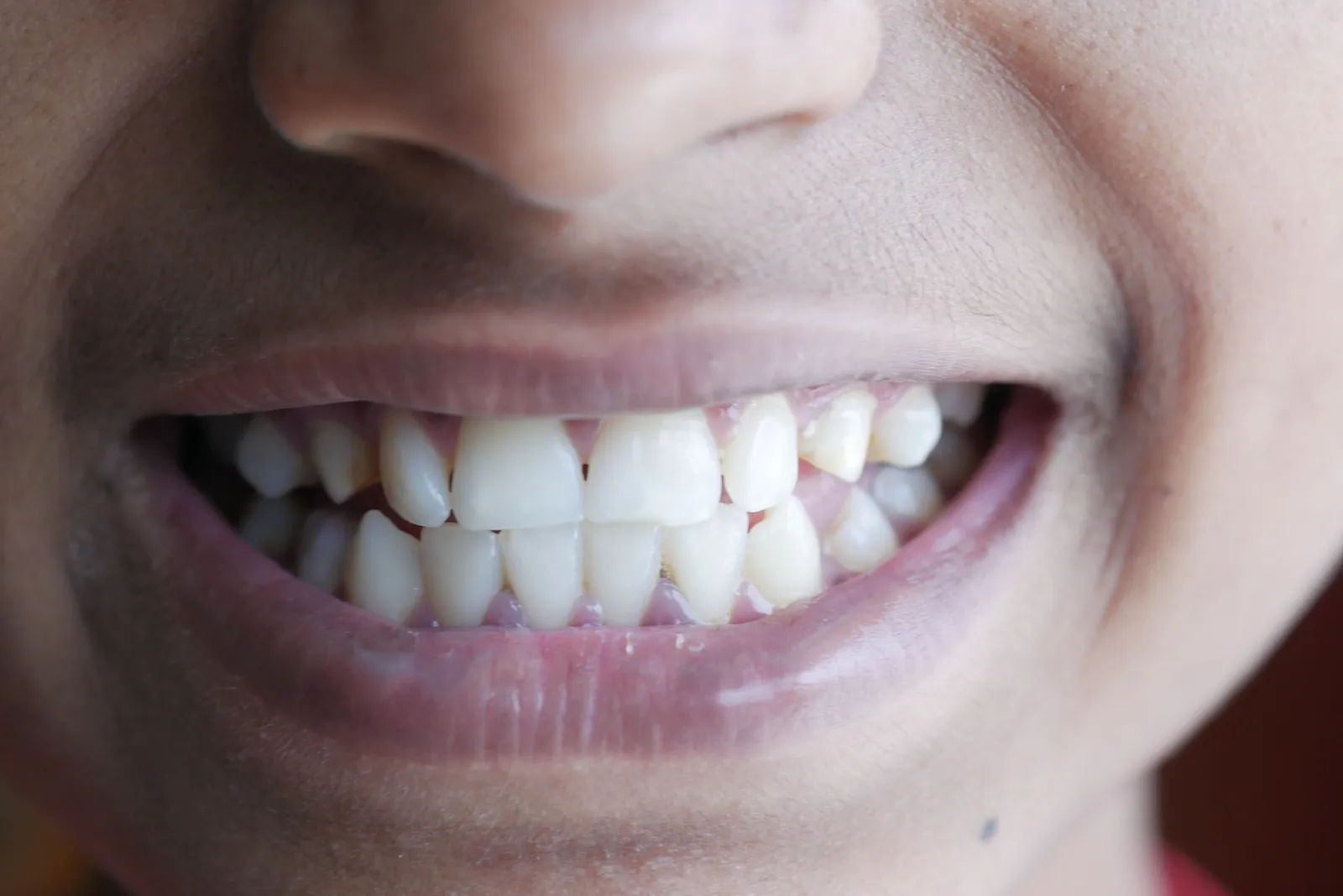 A close view of an even, natural-looking smile.